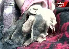 A young girl lies on a blanket, 'liberated' of her life by invader weaponry.